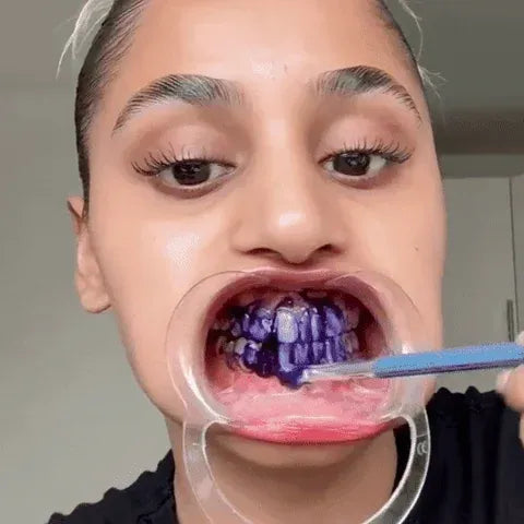 Hismile - Teeth Brightening Serum V34 (Original)